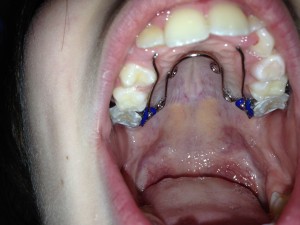 IMG_2396.JPG